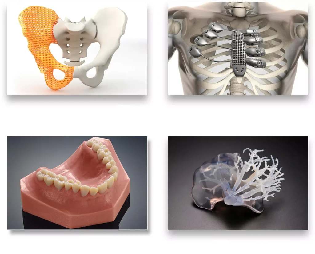 3D printing can produce a variety of medical plastic model products.webp