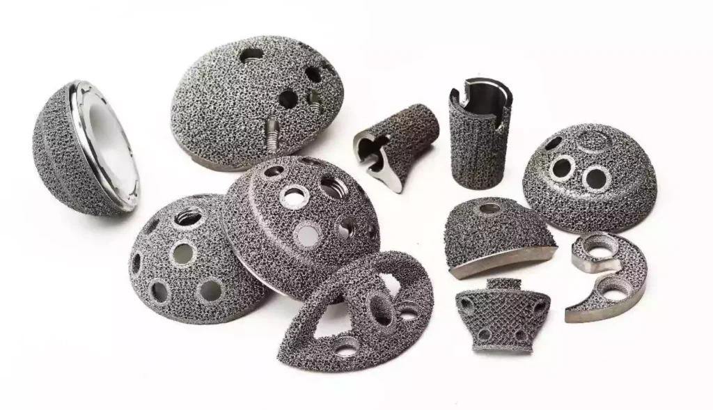 3D printing rapid prototyping of medical metal implant products